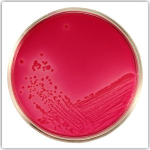 insibio-e-coli